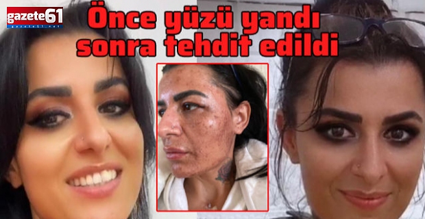 Hayatının kabusunu yaşadı!