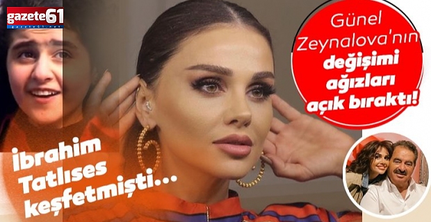 Günel Zeynalova'nın değişimi ağızları açık bıraktı!