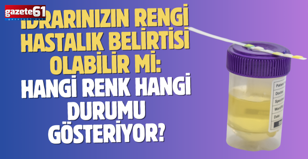 İdrarınızın rengi hastalık belirtisi olabilir mi: Hangi renk hangi durumu gösteriyor?