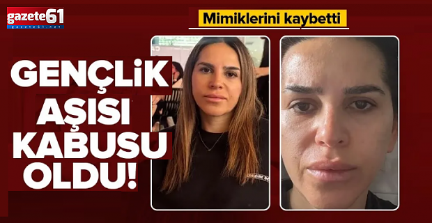 Yüz felci geçirdi, mimiklerini kaybetti: "Gülmeyi unuttum"