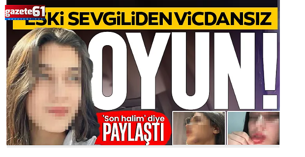 Erkek arkadaş dehşeti! Konuşacağız diye çağırıp darbetti!