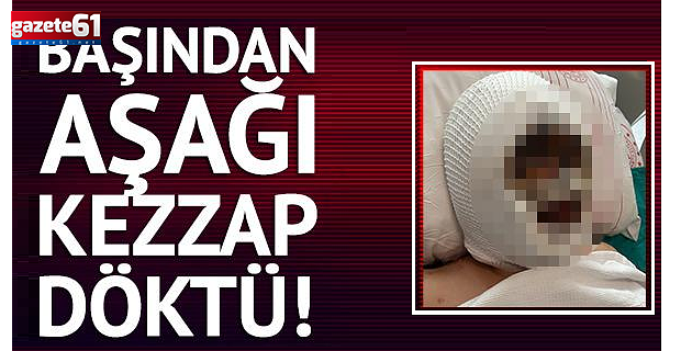 Eski eşinin başından aşağı kezzap döktü! Olay yerinden kaçtı