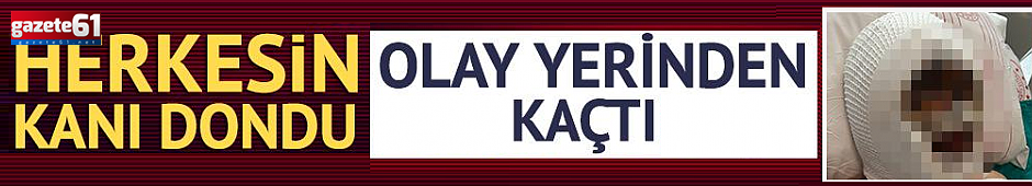 Eski eşinin başından aşağı kezzap döktü! Olay yerinden kaçtı