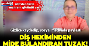 Diş hekiminden mide bulandıran gizli kamera tuzağı