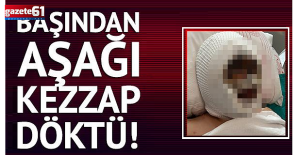 Eski eşinin başından aşağı kezzap döktü! Olay yerinden kaçtı